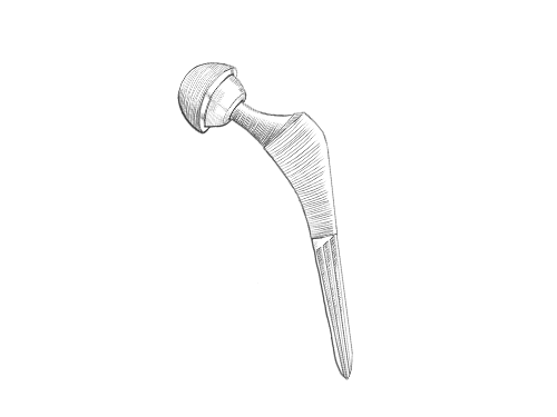 Defective Medical Device Hip Replacement