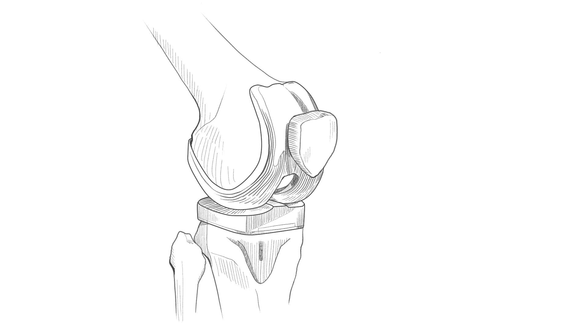 Discover 75+ sketch of knee joint - seven.edu.vn