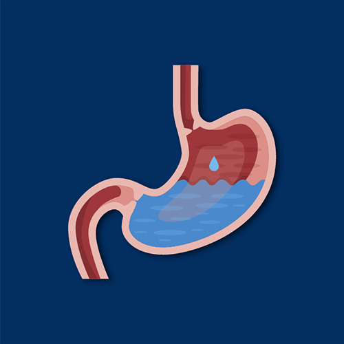Illustration of a stomach