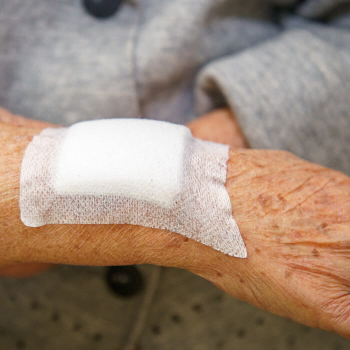 signs of nursing home abuse bruises