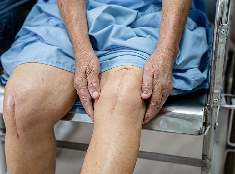 Oklahoma Depuy lawsuits.