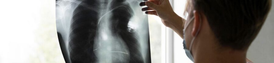 Mesothelioma Lawsuits