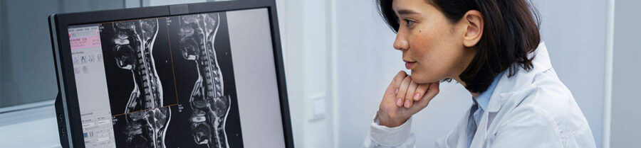 Spinal Cord Injury Attorneys
