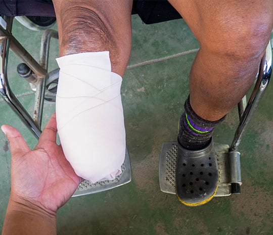 What is a catastrophic injury?